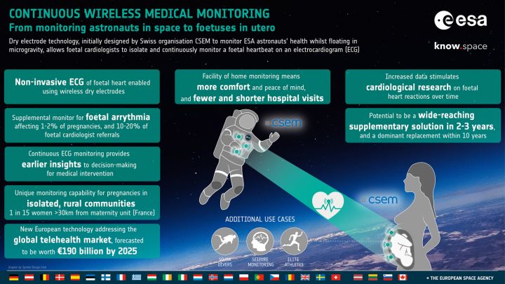 ESA Technology Transfer Success Story - Dry electrodes to monitor vital signs: From astronauts in space to foetuses in utero